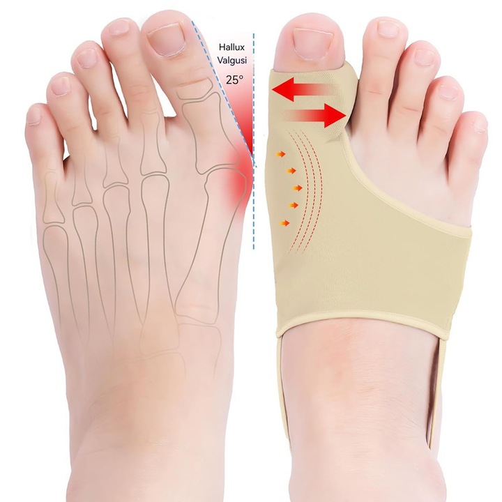 Set 4 protectii pentru monturi si separator degete, YSBER, Nylon, Marime Universala, Bej