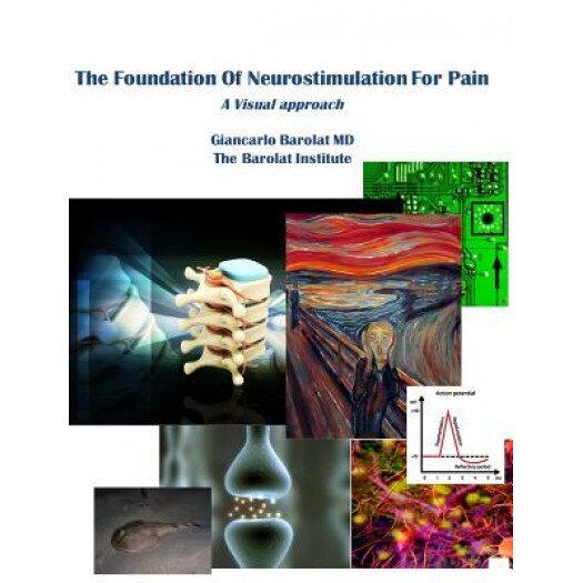 The Foundation of Neurostimulation for Pain, Giancarlo Barolat (Author)