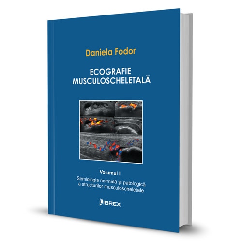 Ecografie musculoscheletala - Daniela Fodor - Vol. I