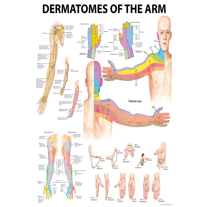 Anatómiai poszter A kar dermatómái, A felső végtag dermatómái, 70x50