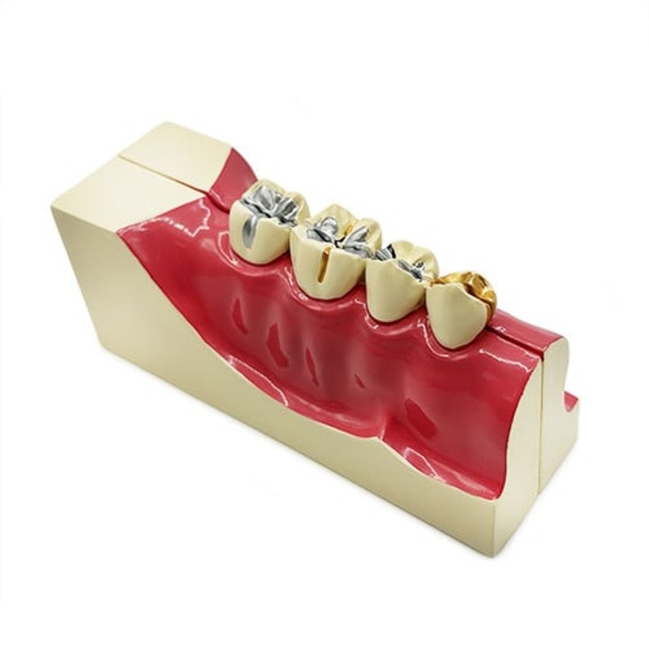 Model educational sectiune mandibula YL-M9