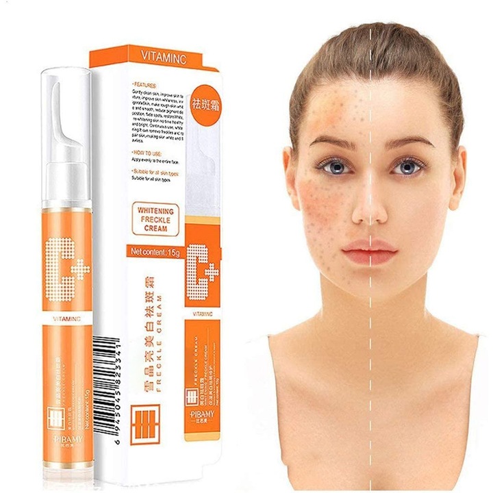 15гр Избелващ крем против петна VC Избелващ крем за премахване на петна от лунички