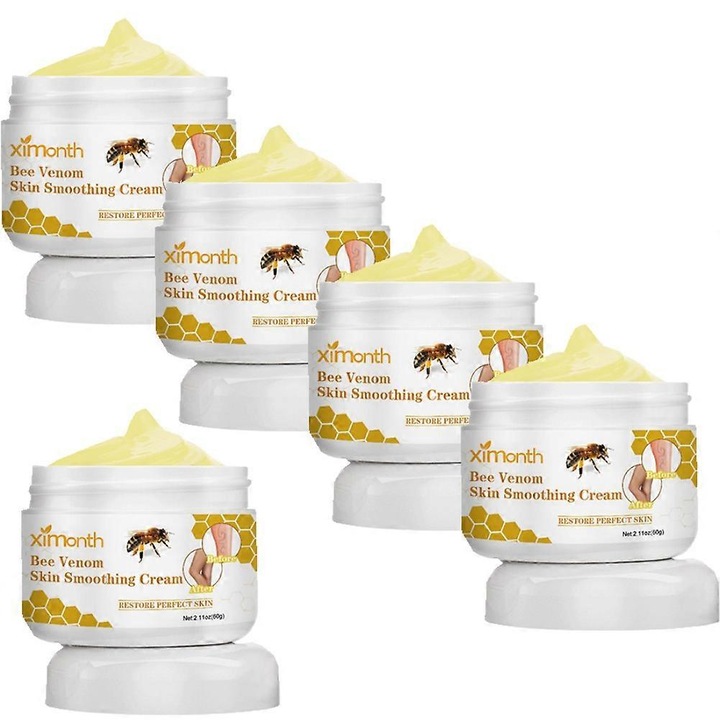 Ximonth visszérkrém, 60g, véna javító hatás, minden bőrtípusra, 5 darabos szett