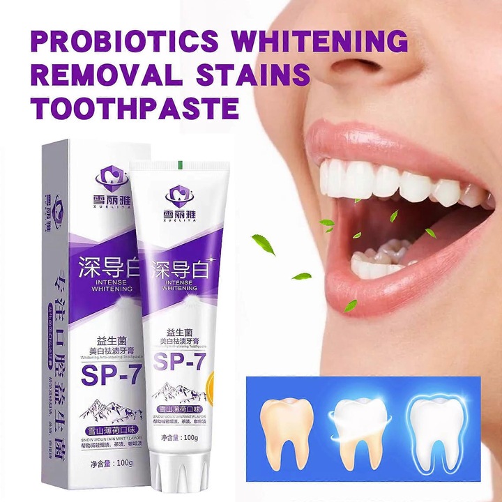Sp- Fogkrém Friss Lehelet Fogkrém Sp-7 Ultra Whitening Sp-7 Probiotikus Fehérítő Fogkrém 100g