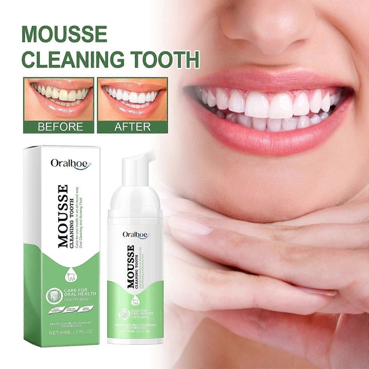 Physician's probiotikus fehérítő fogkrém a frissítő leheletért, a sárgás elszíneződés és foltok eltávolításáért, valamint a szájszag javításáért 60ml