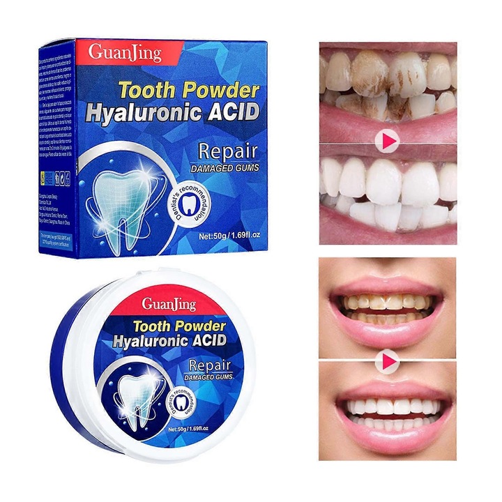 Folteltávolítás Javítja a sárga fogakat Friss lehelet Rossz lehelet Probiotikus fehér fogak Fogpor