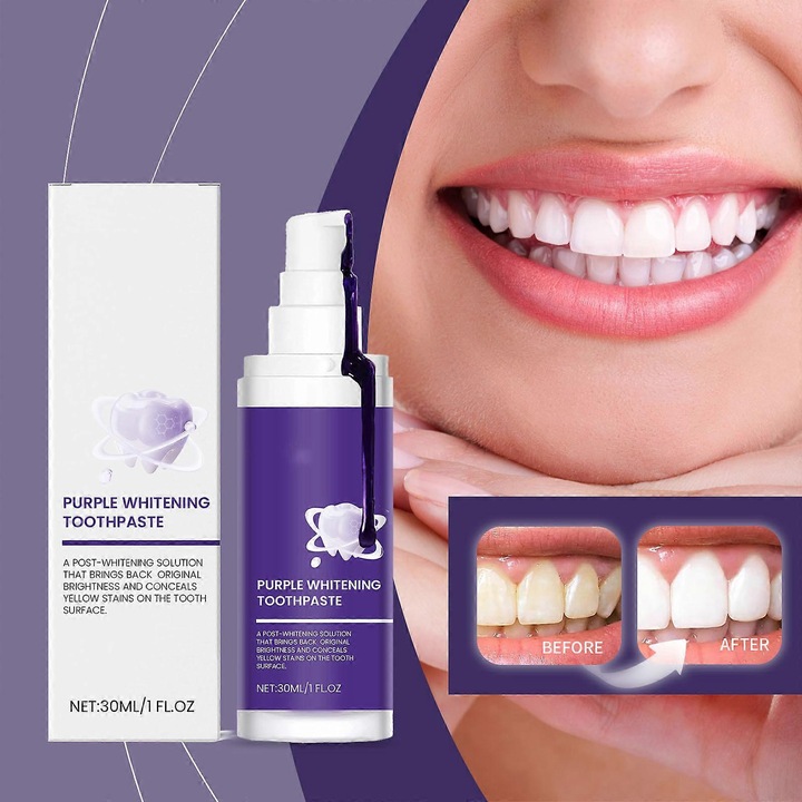 Purple Whitening fogkrém Fehérítő folteltávolító fogkrém Sárga fogak Friss lehelet 30ml