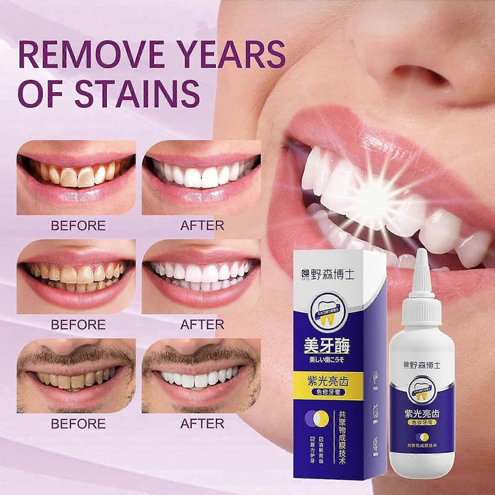 Felnőtt fehérítő fogkrém, lila fehér fogkrém 50g, lila színkorrekciós gél, fogtisztító gél 50g