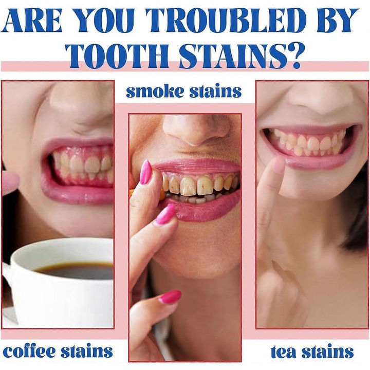 Sp7 fogkrém Ultra Whitening fogkrém, fluoridmentes fogkrém, egészséges fogakat és ínyt biztosít, megakadályozza a fogkövet, friss leheletet és eltávolítja a sárga foltokat 1 db