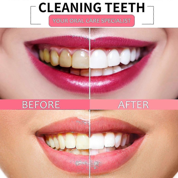 Jaysuing fogkrém fehérítő fogak folteltávolítás ínyvérzés ellen friss lehelet fogkrém szájhigiénia fehérítő ingyenes szállítás Xinda szőlő -833601918