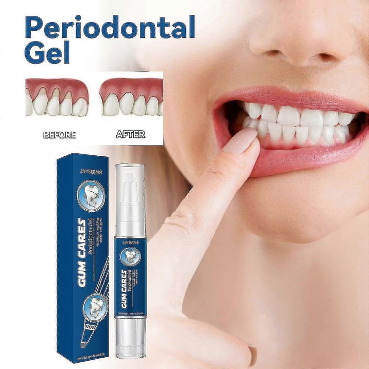 Jaysuing ínyápoló gél mélytisztító fogfoltok, fogkő, duzzadt és fájdalmas íny ellen Bf -3505467060736