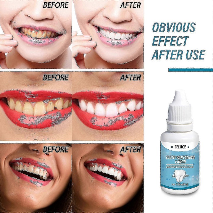 Eelhoe fogfehérítő folyékony fogkefe folyékony fogkefe fekete fog füst fog friss lehelet fehérítő -4326418855213