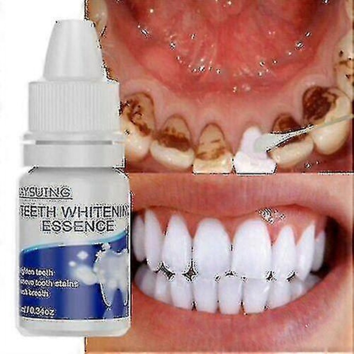 Új fogfehérítő esszenciák extra erős fehérítő fogfehérítő folteltávolító szájhigiéniai fehérítő gél lepedék és foltok eltávolítására, tisztítás Tw E 2Set